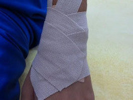 患者さんの症例｜バスケットボール中に転倒し手首をねんざした小学生