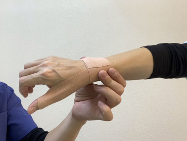 <div>仕事や家事で手を使いすぎると手首や指が痛くなることがあります。</div>
<div></div>
<div>一般的に腱鞘炎と言われ、仕事や家事で手首や指を動かす腱を使いすぎることにより、腱や腱を包んでいる腱鞘が炎症を起こした状態です。</div>
<div></div>
<div>腱鞘炎の症状は、</div>
<div>・手や指を動かすと痛む</div>
<div>・指が曲げ伸ばししづらい</div>
<div>・ドアノブを回すと手首が痛む</div>
<div>・痛みでペットボトルのフタが開けられない</div>
<div>などがあります。</div>
<div></div>
<div>また、妊娠出産の前後に痛むことも多く、</div>
<div>・抱っこすると手首が痛む</div>
<div>・沐浴の時に手首や指が痛む</div>
<div>・哺乳瓶のフタを開けると痛む</div>
<div>といったことも見られます。</div>
<div></div>
<div>今回のブログでは、腱鞘炎でサポーターをしても痛む時の対処法、テーピングの方法や治し方などまとめてみました。</div>
<div></div>
<div>手首や指が痛くて家事や育児や仕事が辛い、という方のお役に立てると思いますので、ぜひご覧ください。</div>
<div></div>
<div><a href="https://youtu.be/kg2KHAEy6T4">腱鞘炎でサポーターをしても手首が痛む時のテーピングと対処法｜今治市　星野鍼灸接骨院</a></div>
<div>手首のサポーターで安静にすると腱鞘炎は楽になる</div>
<div>腱鞘炎腱鞘とは、手首や指の骨と曲げ伸ばしをする筋肉とを繋ぐ、腱の周りにあるトンネルのようなものです。</div>
<div></div>
<div>この腱鞘というトンネルは関節の周りにあり、手首や指を曲げ伸ばしする際に腱がずれないようにする働きがあります。</div>
<div></div>
<div>腱鞘炎は、手首や指を頻繁に使うことで腱と腱鞘が金属疲労のように炎症を起こし、痛みが出たり腫れて動きにくくなっている状態です。</div>
<div></div>
<div>炎症が起こる原因は使い過ぎなので、病院ではサポーターをしたり仕事を休んだりして安静にするように指示されます。</div>
<div></div>
<div>サポーターや包帯やテーピングにより、関節の動きを制限したり筋肉の動きを補助することができるようになるため、炎症が早く改善してきますが、安静が取れず使い続けていると手術が必要になる場合もあり注意が必要です。</div>
<div></div>
<div>サポーターの種類には、指だけをサポートするものや手首もサポートするもの、またプレートが入っていてしっかりと固定するものまでいろいろあります。</div>
<div></div>
<div>手首が痛む腱鞘炎の時のテーピングの方法</div>
<div>腱鞘炎の時のテーピングの方法腱鞘炎は、手首や指の使い過ぎによって腱や腱鞘を傷めてしまうために起こります。</div>
<div></div>
<div>手首や指を安静にして負担を減らすために行うテーピングには、大きく分けて2つの目的別のパターンがあります。</div>
<div></div>
<div>一つは運動を制限するため、もう一つは腱と筋肉の動きを補助するためのものです。</div>
<div></div>
<div>運動を制限するためのテーピングは、使う量を減らし炎症を早く引かせる目的があり、サポーターもこの目的で使います。</div>
<div></div>
<div>●基本の貼り方・手首</div>
<div>手首の親指側の骨の上から、手首を巻くようにクルッと貼る</div>
<div></div>
<div><a href="https://www.starlife2004.com/wp-content/uploads/2022/01/2022-01-27-11.43.59-scaled-e1643252260137-290x300.jpg">手首の親指側の骨の上から、手首を巻くようにクルッと貼る（貼りはじめ）</a></div>
<div></div>
<div><a href="https://www.starlife2004.com/wp-content/uploads/2022/01/2022-01-27-11.44.09-scaled-e1643252214385-300x280.jpg">手首の親指側の骨の上から、手首を巻くようにクルッと貼る（貼り終わり）</a></div>
<div>もう一つの腱と筋肉の動きを補助するテーピングは、曲げ伸ばしをしやすくすることで腱鞘にかかる負担を減らし、炎症を起こしにくくする目的があります。</div>
<div></div>
<div>手首や指を曲げ伸ばしする筋肉や腱をテーピングによってもう一本増やすことで、腱にかかる負担を減らすイメージです。</div>
<div></div>
<div>●基本の貼り方・指</div>
<div>指を伸ばした状態で、爪の手前から手首に向かってテープを貼る（手の甲側が痛む場合）</div>
<div></div>
<div><a href="https://www.starlife2004.com/wp-content/uploads/2022/01/2022-01-27-11.44.36-scaled-e1643252190980-300x271.jpg">手の甲側が痛む場合①</a></div>
<div><a href="https://www.starlife2004.com/wp-content/uploads/2022/01/2022-01-27-11.44.48-scaled-e1643252171345-286x300.jpg">手の甲側が痛む場合②</a></div>
<div><a href="https://www.starlife2004.com/wp-content/uploads/2022/01/2022-01-27-11.44.52-scaled-e1643252148726-276x300.jpg">手の甲側が痛む場合③</a></div>
<div></div>
<div>指を伸ばした状態で、指の腹から手首に向かってテープを貼る（手のひら側が痛む場合）</div>
<div></div>
<div><a href="https://www.starlife2004.com/wp-content/uploads/2022/01/2022-01-27-11.45.05-scaled-e1643252110460-300x226.jpg">手のひら側が痛む場合①</a><br /><a href="https://www.starlife2004.com/wp-content/uploads/2022/01/2022-01-27-11.45.11-scaled-e1643252087143-300x277.jpg">手のひら側が痛む場合②</a></div>
<div><a href="https://www.starlife2004.com/wp-content/uploads/2022/01/2022-01-27-11.45.17-scaled-e1643252068528-300x268.jpg">手のひら側が痛む場合③</a></div>
<div></div>
<div>テーピングは一つのパターンを行う場合もありますし、両方の目的を合わせて行う場合もあります。</div>
<div></div>
<div>基本的な形がありますので、それぞれの場所に合わせて貼ってみてください。</div>
<div></div>
<div>腱鞘炎でサポーターをしても手首が痛む時の治し方</div>
<div>安静にするためにサポーターやテーピングをして過ごしていても、なかなか治らない時があります。</div>
<div></div>
<div>使う頻度が多くてなかなか休めなかったり、サポーターやテーピングで肌がかぶれてしまい装着できなかったり。</div>
<div></div>
<div>いろいろな原因で痛みが出るときや、より早く楽になるために自宅でできる改善方法があります。</div>
<div></div>
<div>今回は、手首の使い方についてお伝えします。</div>
<div></div>
<div>●手首の使い方</div>
<div>腱鞘炎は、何かを持った状態で手首を動かすと炎症が起こりやすくなります。</div>
<div></div>
<div>特に強く握ったり指先でつまんでいる状態で手首を動かすことが、腱鞘の負担になる原因です。</div>
<div></div>
<div>一度試していただきたいことがあります。</div>
<div></div>
<div>手のひらを下にして手を握ってみてください。</div>
<div><a href="https://www.starlife2004.com/wp-content/uploads/2022/01/2022-01-27-12.00.26-scaled-e1643252728343.jpg">手のひらを下にして手を握る</a></div>
<div></div>
<div>手首の使い方そうすると、手の甲が自分の方に向きませんでしたか？</div>
<div>実は、指を握ると自然と手首が返るようになっています。</div>
<div></div>
<div>ですので、細かい作業や指で摘んで物を持ち上げる動作の時は、手首が返る状態で作業するのがポイントです。</div>
<div><a href="https://www.starlife2004.com/wp-content/uploads/2022/01/2022-01-27-12.00.47-scaled-e1643252669566.jpg">指を握ると自然と手首が返る</a></div>
<div></div>
<div>手首の使い方どうしても手首が返せない時には、つまんだ状態で手首をなるべく動かさないようにすると負担の軽減になります。</div>
<div></div>
<div>つまり、手首を曲げ伸ばしする際には、動かす幅を減らしたり肩から大きく動かすようにすると、腱鞘炎を予防したり痛みを軽減することができるということです。</div>
<div></div>
<div>腱鞘炎は無理な状態で使うことが多くなることで起こります。</div>
<div></div>
<div>少しでも早く症状を軽減するために、ぜひ参考にしてみてください。</div>
<div></div>
<div>（鍼灸師・あんまマッサージ指圧師・柔道整復師　星野泰隆監修）</div><div class="news_area is_type01"><div class="thumnail"><a href="https://youtu.be/kg2KHAEy6T4"><div class="image"><img src="https://prtree.jp/sv_image/w640h640/Ov/uP/OvuPSvbiFHpaoFIX.jpg"></div><div class="text"><h3 class="sitetitle">腱鞘炎でサポーターをしても手首が痛む時のテーピングと対処法｜今治市　星野鍼灸接骨院</h3><p class="description">★ホームページはこちら★https://www.starlife2004.com/trouble/kata-kori/LINEにご登録頂くと、無料で健康相談が受けられます。★LINE登録はこちら★https://lin.ee/MGteZSl★チャンネル登録お願いします★https://www.youtube.co...</p></div></a></div></div> ()